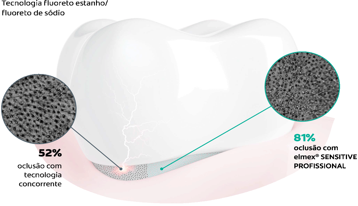 Tecnologia PRO-ARGIN